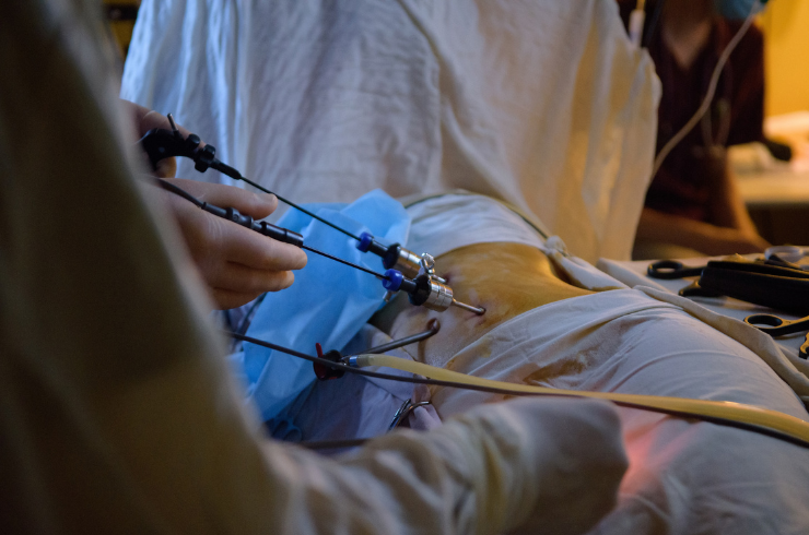 Laparoscopic Surgery in Prayagraj